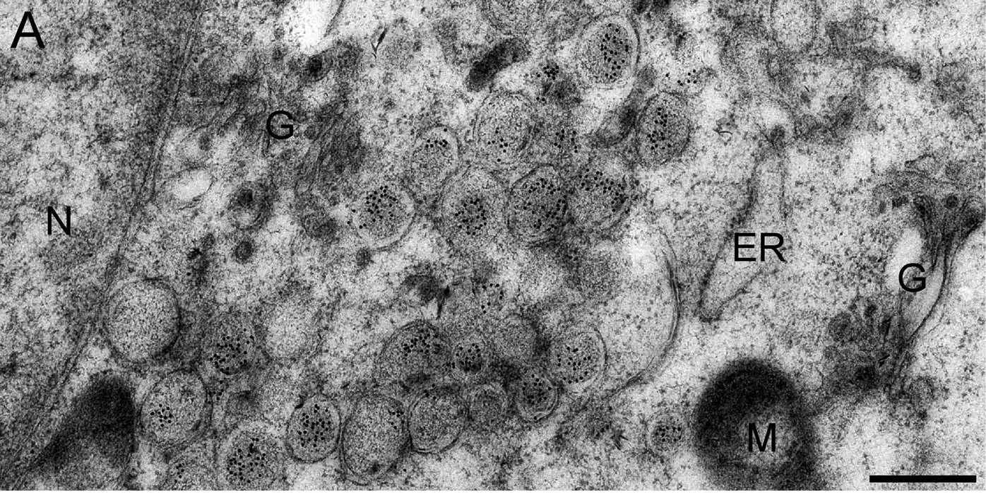 Figure 3. Immune electron microscopy image, where J2 antibody labeling shows abundance of dsRNA (black dots) in double-membrane vesicles (DMVs) of SARS-CoV infected Vero E6 cells, fixed at 7 hours post-infection. J2 was detected using immunogold conjugated to protein A. G: Golgi complex, M: mitochondria, N: nucleus. Figure taken from Knoops et al. (2008) PLoS Biol 6:e226.